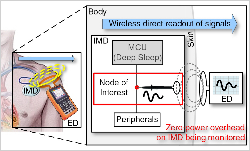 Zero-power Contactless Probing for IMDs