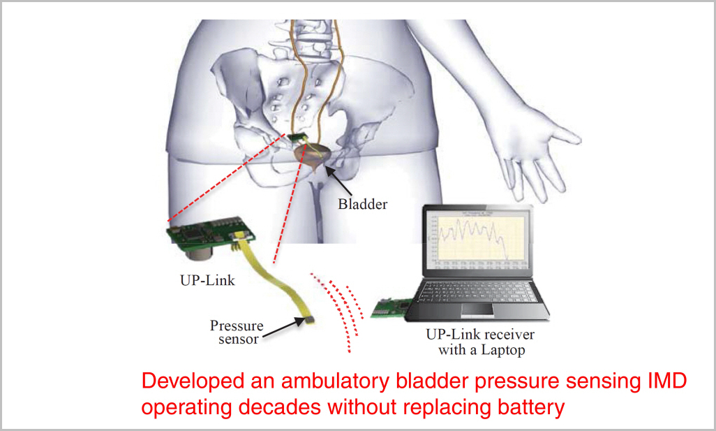 Bladder Pressure Sensing IMD